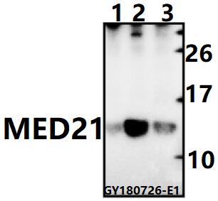 Western blot (WB) analysis of MED21 polyclonal antibody at 1:500 dilution
Lane1:CT26 whole cell lysate(40ug)
Lane2:HEK293T whole cell lysate(40ug)
Lane3:HCT116 whole cell lysate(40ug)