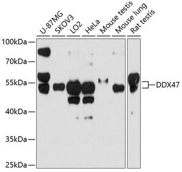 Western blot analysis of extracts of various cell lines, using DDX47 antibody  at 1:1000 dilution