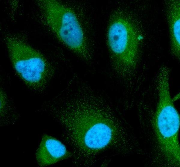 a10278 1 timm44 primary antibodies if testing 1