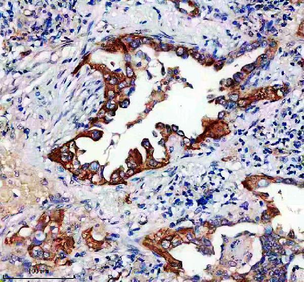 IHC analysis of TIMM44 using anti-TIMM44 antibody (A10278-1)
