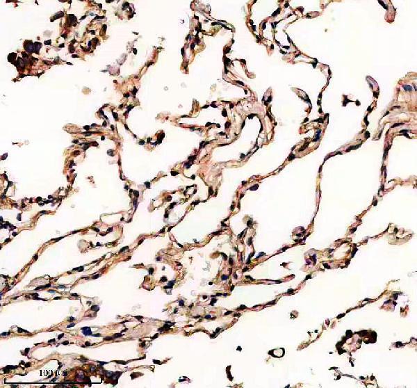 IHC analysis of TIMM44 using anti-TIMM44 antibody (A10278-1)