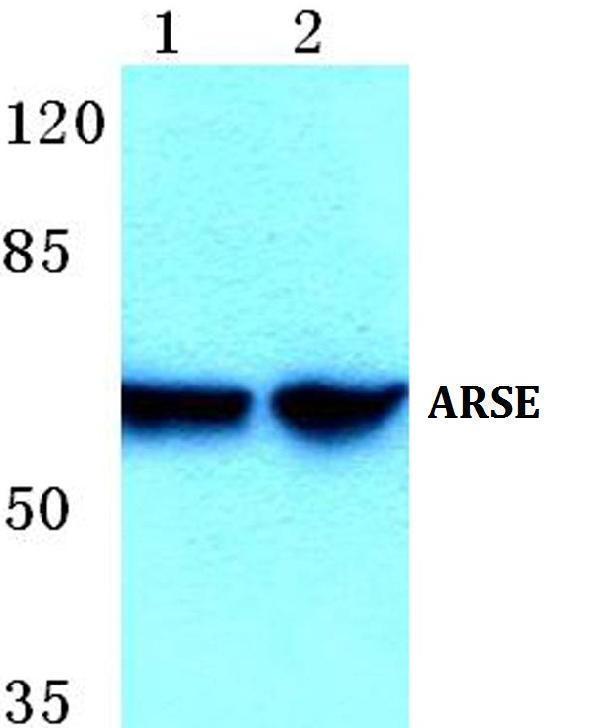 a10294 1 arse primary antiboties wb testing 1
