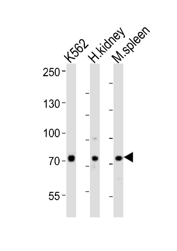 Western blot analysis of lysates from K562 cell line, human kidney, mouse spleen tissue (from left to right), using SDAD1 Antibody (C-term). A10299 was diluted at 1:1000 at each lane. A goat anti-rabbit IgG H&L (HRP) at 1:10000 dilution was used as the secondary antibody. Lysates at 20ug per lane.