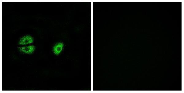 a10300s22 1 mrps22 primary antibodies if testing 1