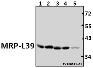 Western blot (WB) analysis of MRphospho-L39 (E326) polyclonal antibody at 1:1000 dilution
Lane1:PC12 whole cell lysate(40ug)
Lane2:CT26 whole cell lysate(40ug)
Lane3:HCT116 whole cell lysate(40ug)
Lane4:Hela whole cell lysate(20ug)
Lane5:A375 whole cell lysate(40ug)