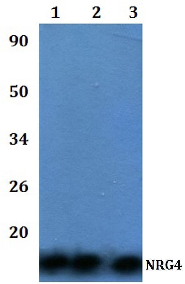 Western blot (WB) analysis of NRG4 polyclonal antibody at 1:500 dilution  Lane1:HEK293T whole cell lysate
Lane2:RAW264