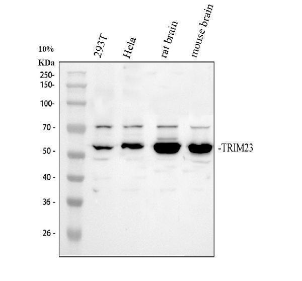 Western blot analysis of TRIM23 using anti-TRIM23 antibody (A10305-1)