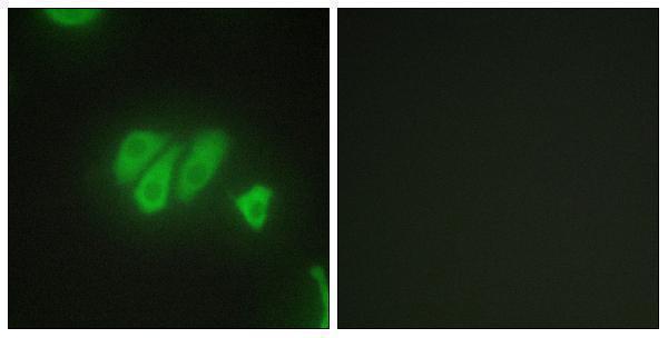 a10309 1 pdzd2 primary antibodies if testing 1
