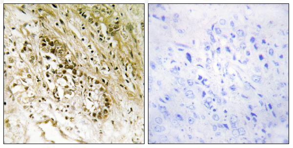a10309 1 pdzd2 primary antibodies ihc testing 2