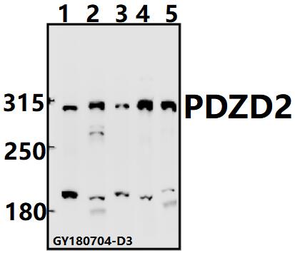 Western blot (WB) analysis of PDZD2 pAb at 1:500 dilution
Lane1:PC3 whole cell lysate(40ug)
Lane2:Hela whole cell lysate(40ug)
Lane3:SGC7901 whole cell lysate(40ug)
Lane4:CT26 whole cell lysate(40ug)
Lane5:H9C2 whole cell lysate(40ug)