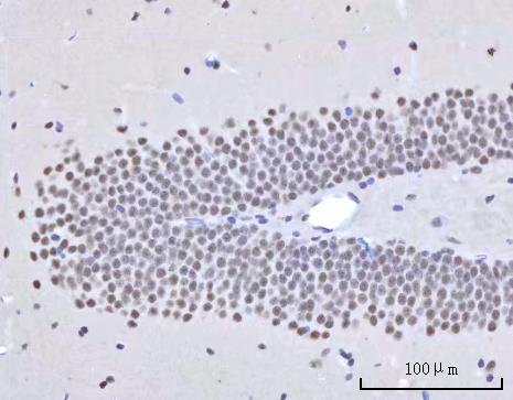 a10311 1 rbm22 primary antibodies ihc testing 11