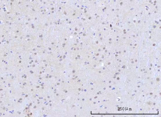 a10311 1 rbm22 primary antibodies ihc testing 12