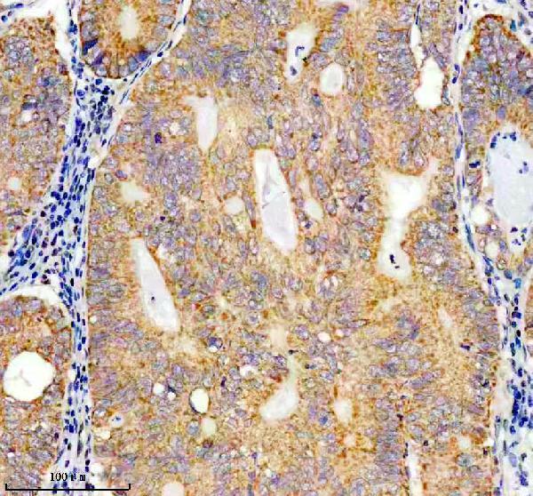 IHC analysis of SACM1L using anti-SACM1L antibody (A10315-1)