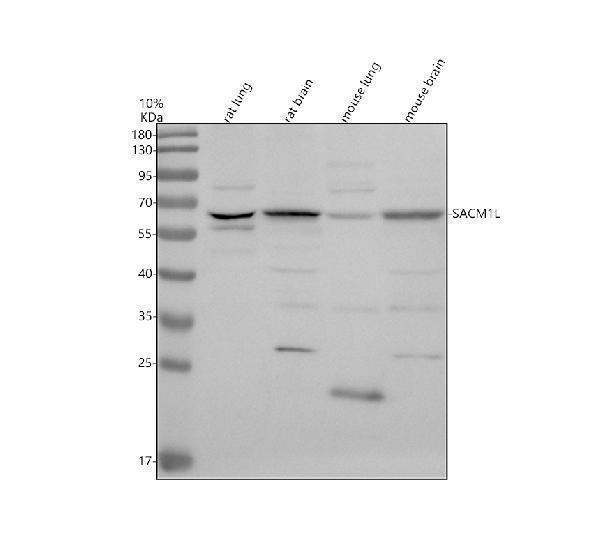 Western blot analysis of SACM1L using anti-SACM1L antibody (A10315-1)