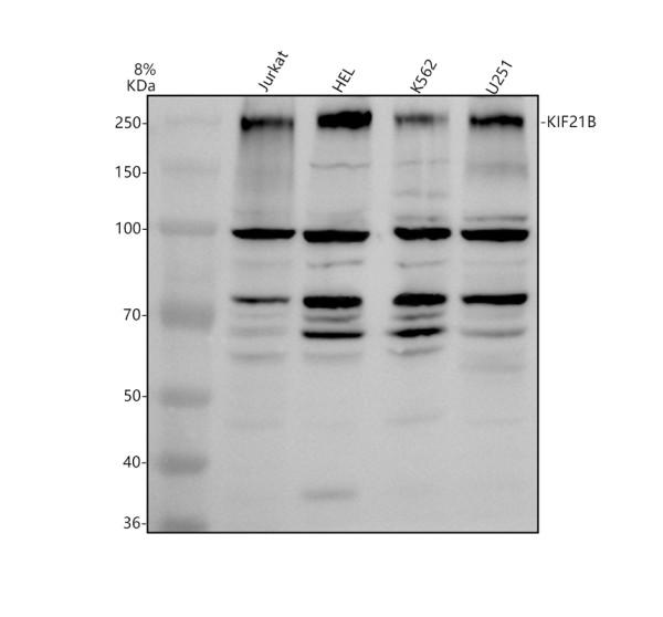a10321 1 kif21b primary antibodies wb testing 1