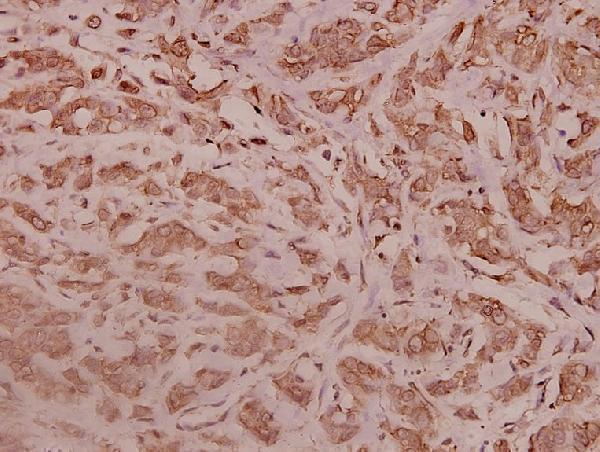 a10323y77 rpl28 primary antiboties ihc testing 2