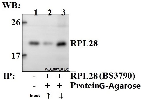 a10323y77 rpl28 primary antiboties ip testing 3