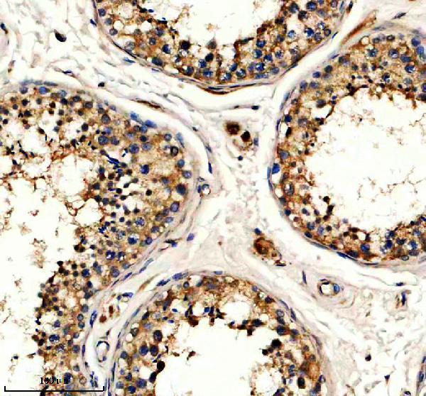 IHC analysis of GPX5 using anti-GPX5 antibody (A10324-1)