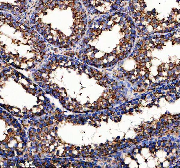 IHC analysis of GPX5 using anti-GPX5 antibody (A10324-1)