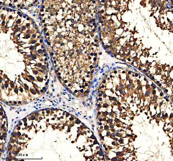 a10324 1 gpx5 primary antibodies ihc testing 3