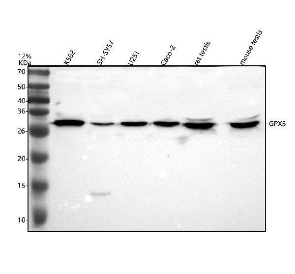 Western blot analysis of GPX5 using anti-GPX5 antibody (A10324-1)