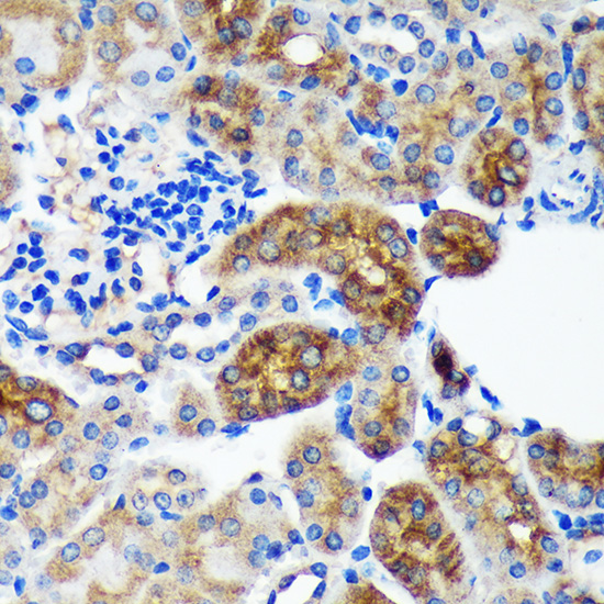 a10327 pycr2 primary antiboties ihc testing 2