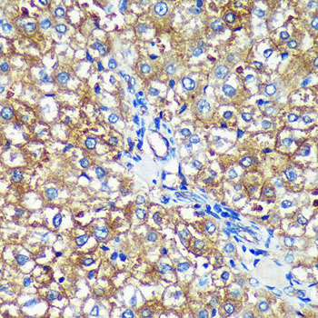 a10327 pycr2 primary antiboties ihc testing 3