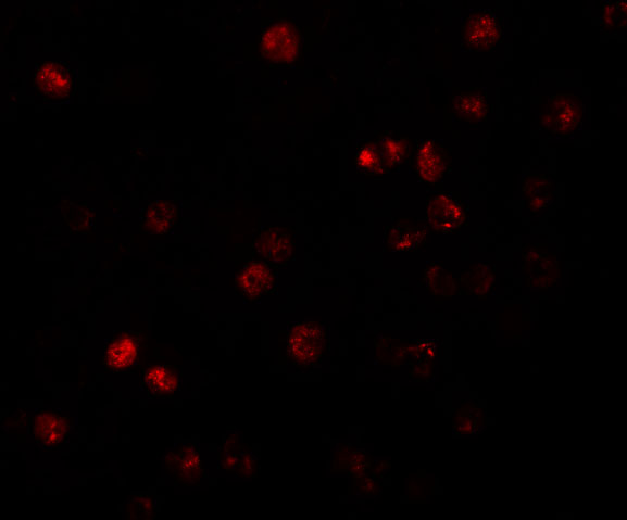 Immunofluorescence of ATP11B in K562 cells with ATP11B antibody at 20 μg/mL