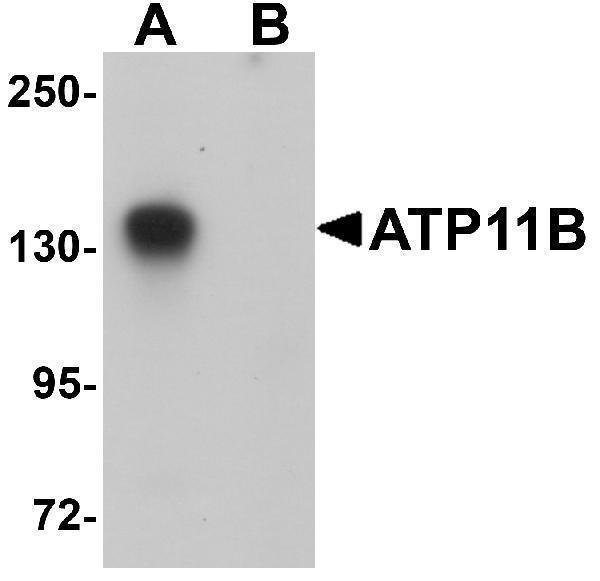 Western blot analysis of ATP11B in K562 cell tissue lysate with ATP11B antibody at 1 μg/mL in (A) the absence and (B) the presence of blocking peptide