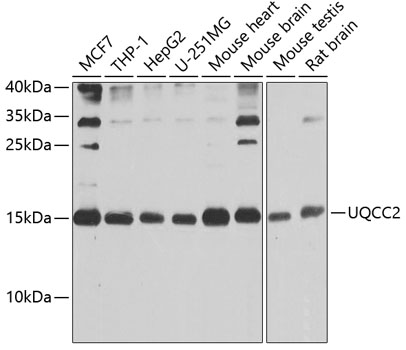 Western blot analysis of extracts of various cell lines, using UQCC2 antibody  at 1:1000 dilution
