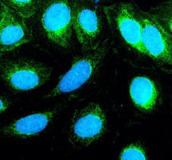 IF analysis of TNIP3 using anti-TNIP3 antibody (A10336-1)