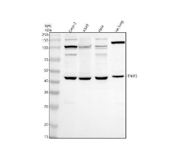 Western blot analysis of TNIP3 using anti-TNIP3 antibody (A10336-1)