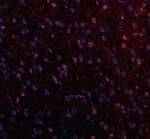 a10337 2 ncdn primary antibodies if testing 1