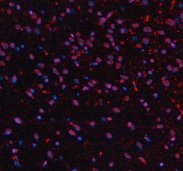 a10337 2 ncdn primary antibodies if testing 2