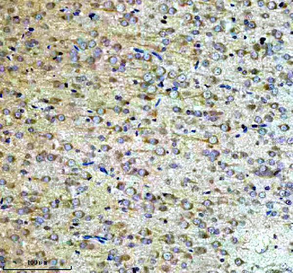 a10337 2 ncdn primary antibodies ihc testing 2