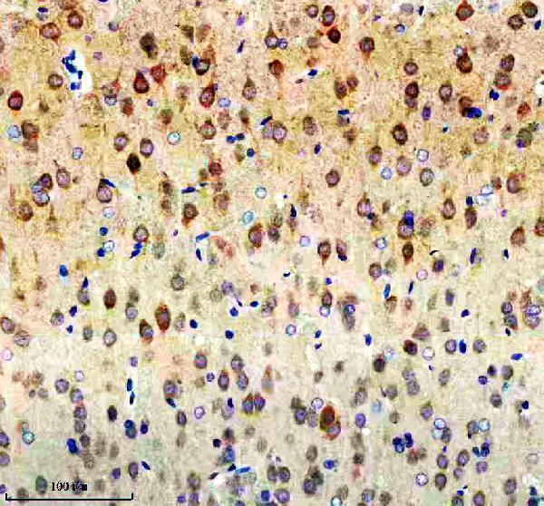a10337 2 ncdn primary antibodies ihc testing 3