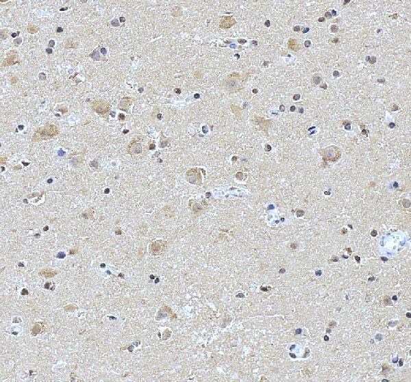 a10337 2 ncdn primary antibodies ihc testing 4