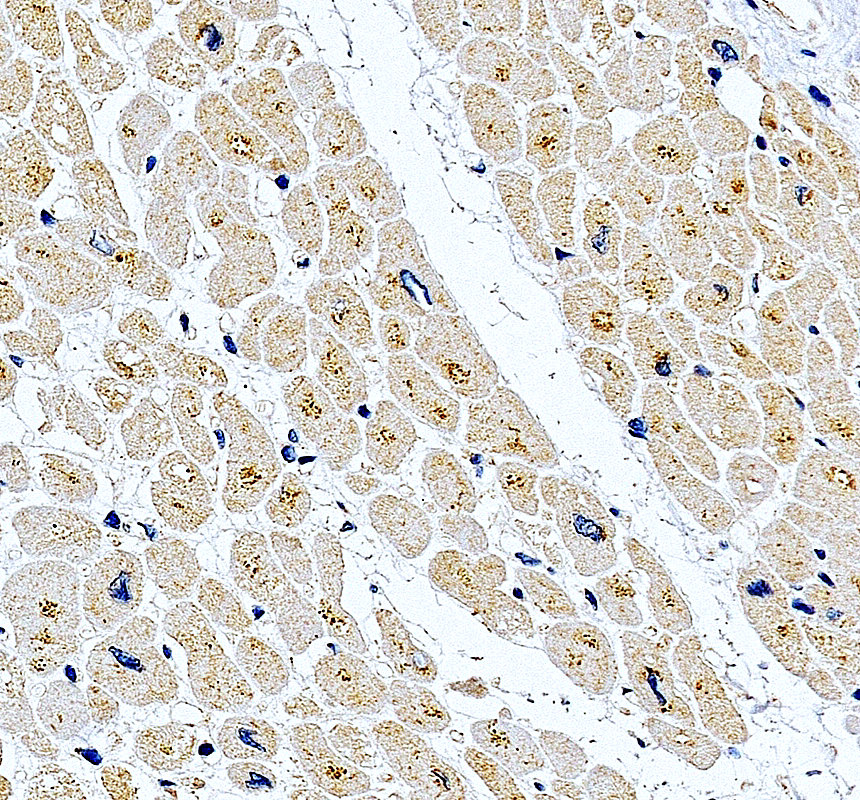 IHC analysis of MYOZ1 using anti-MYOZ1 antibody (A10346-3)