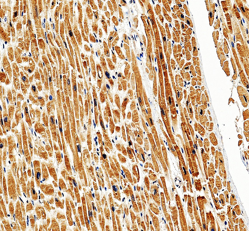IHC analysis of KLHL41 using anti-KLHL41 antibody (A10352)