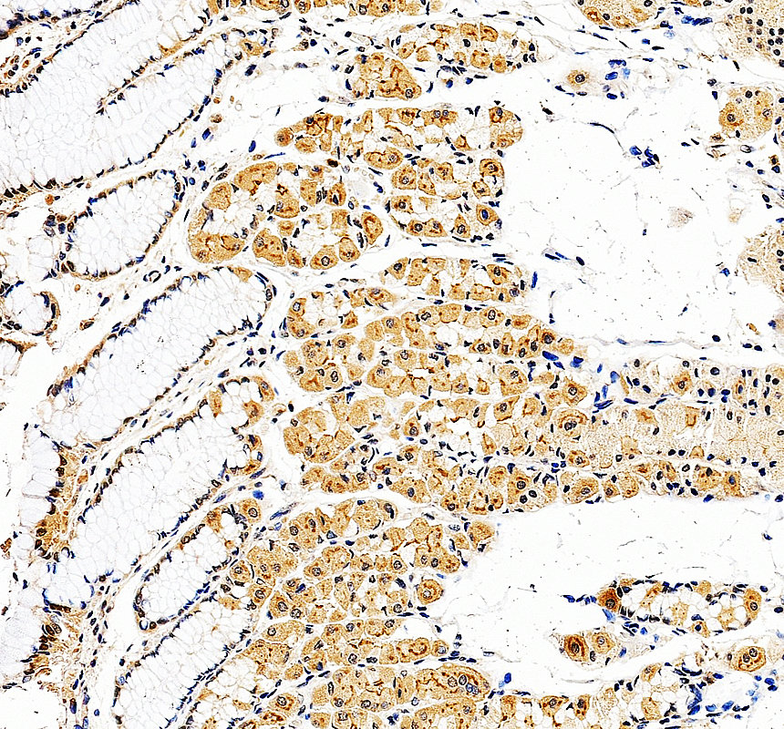 IHC analysis of KLHL41 using anti-KLHL41 antibody (A10352)