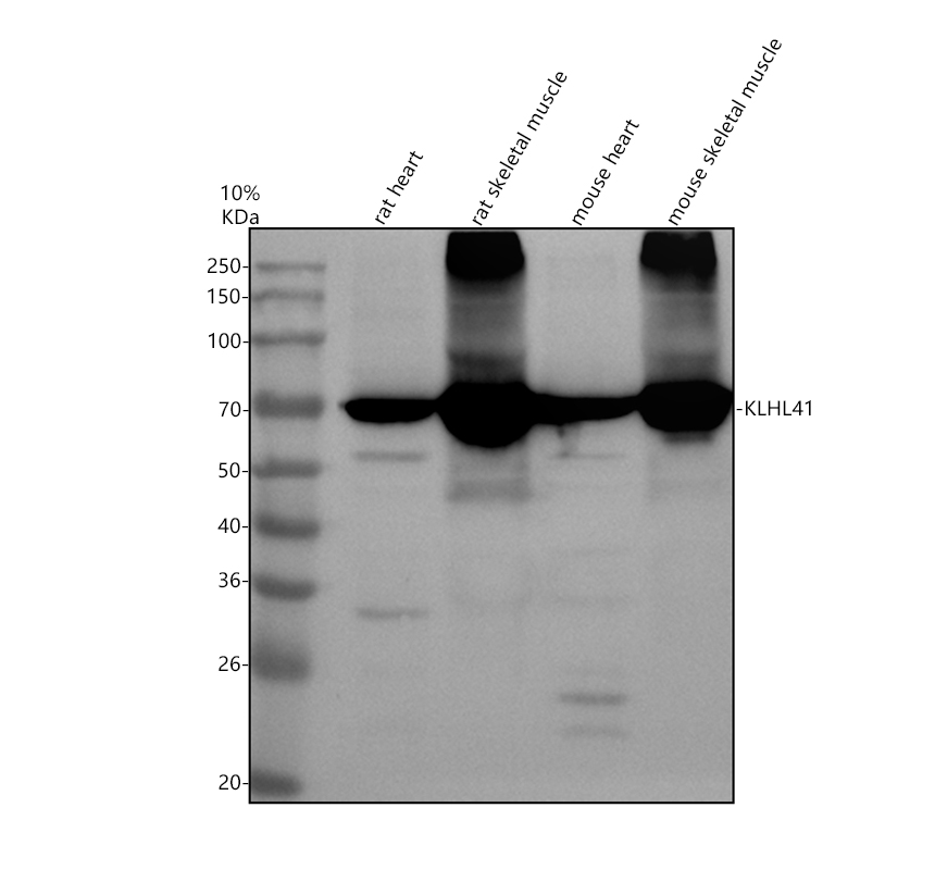 Western blot analysis of KLHL41 using anti-KLHL41 antibody (A10352)