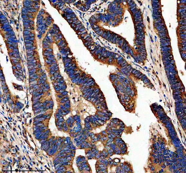 IHC analysis of GPR107 using anti-GPR107 antibody (A10357-2)