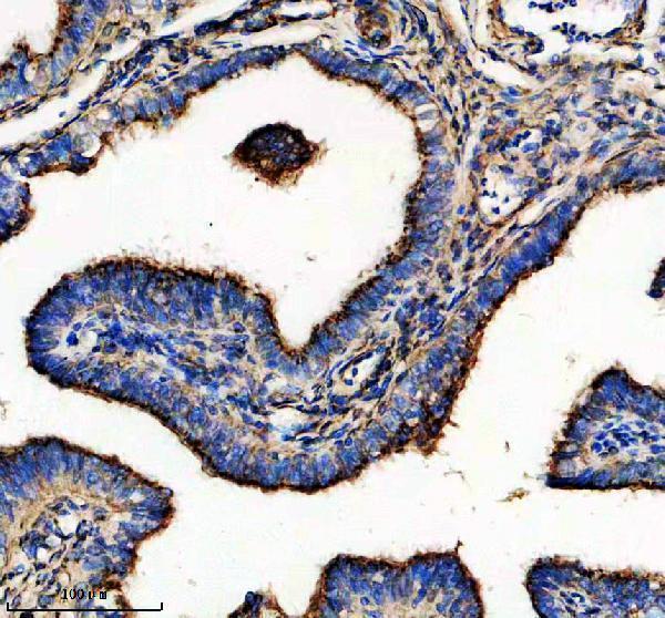 IHC analysis of GPR107 using anti-GPR107 antibody (A10357-2)