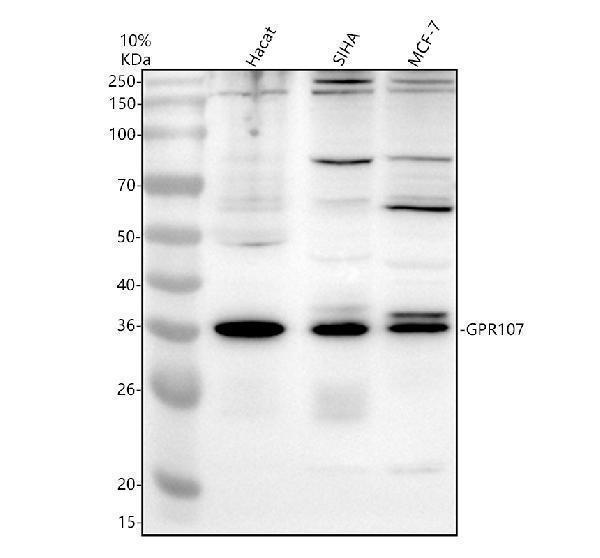 Western blot analysis of GPR107 using anti-GPR107 antibody (A10357-2)