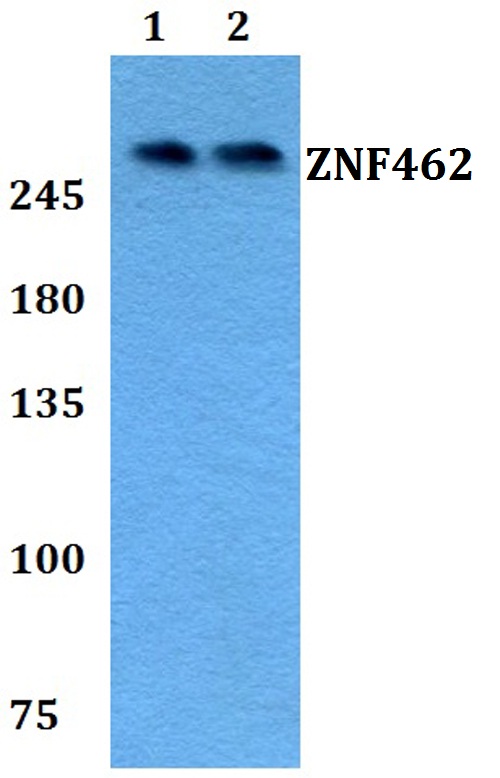 a10366 znf462 primary antiboties wb testing 1