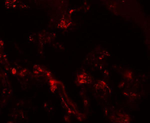 a10368 tm4sf1 primary antibodies if testing 3