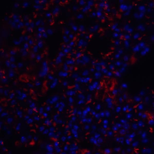 a10368 tm4sf1 primary antibodies if testing 5