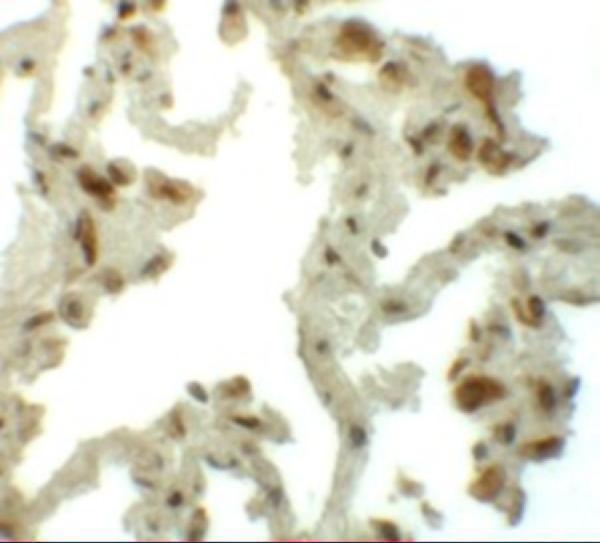 a10368 tm4sf1 primary antibodies ihc testing 2