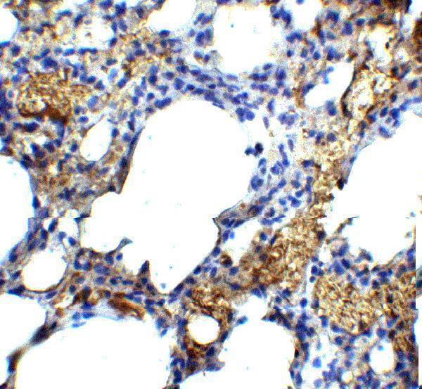 a10368 tm4sf1 primary antibodies ihc testing 4