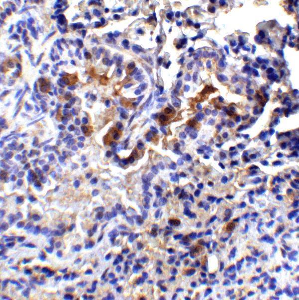 a10368 tm4sf1 primary antibodies ihc testing 6